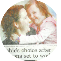 Deformational plagiocephaly flat head media article