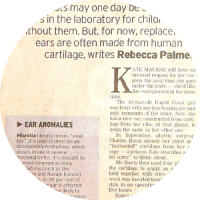 Ear reconstruction surgery media article