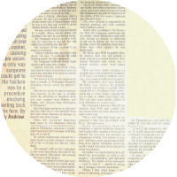 Eye socket surgery media article