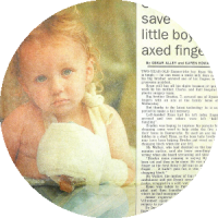 Finger plastic surgery media article