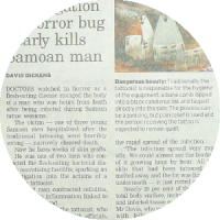 Infected tattoo media article