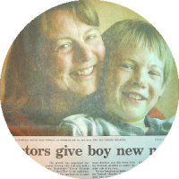 Nose reconstruction surgery media article