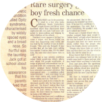 Opitz syndrome cosmetic surgery media article